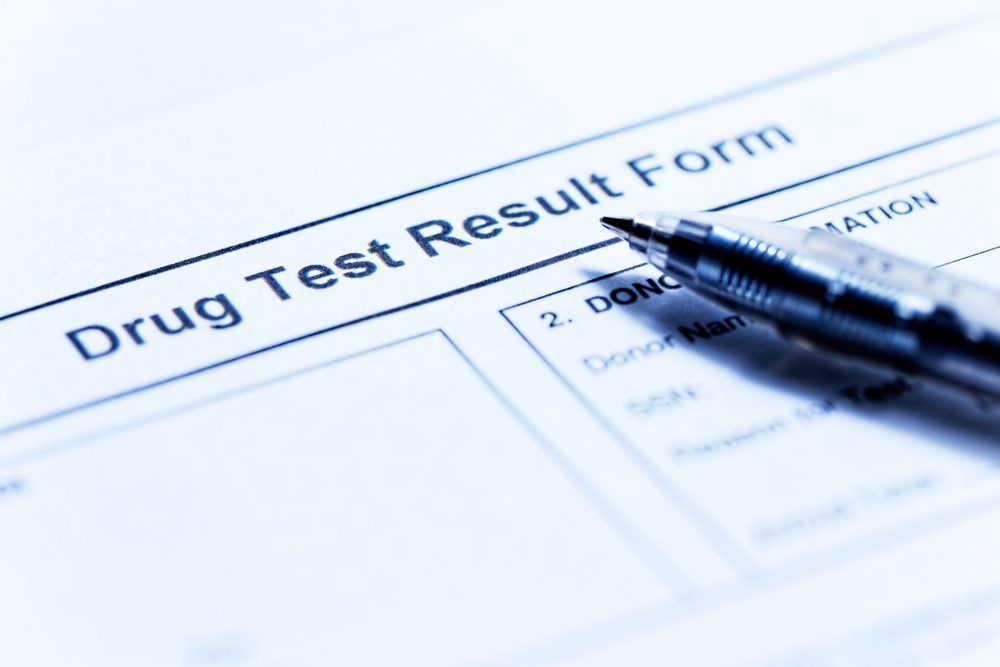 Drug Test, Delta 10 THC, Delta 10 Products